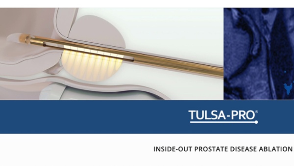 Tulsa Pro Prostate Cancer Treatment